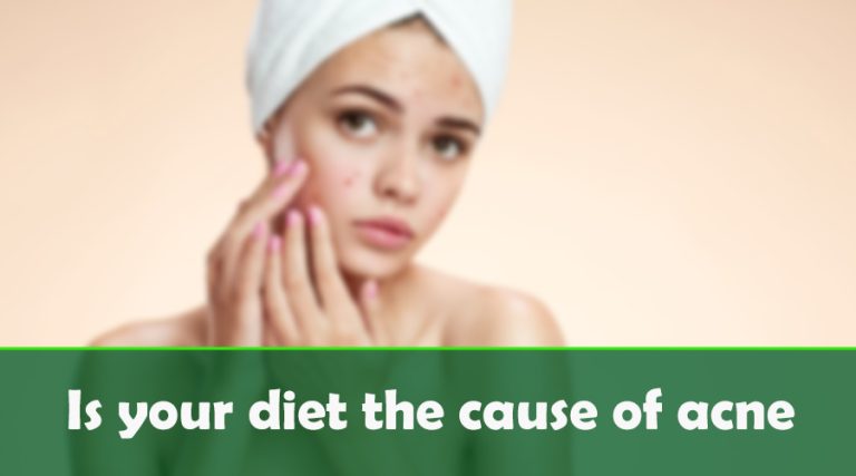 Is your diet the cause of acne