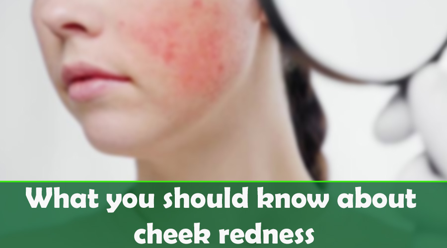 What you should know about cheek redness